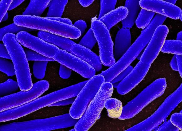 e. coli bacteria